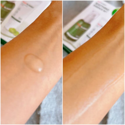 レッドブレミッシュスージングアクティブエッセンス/Dr.G/ブースター・導入液を使ったクチコミ(6枚目)