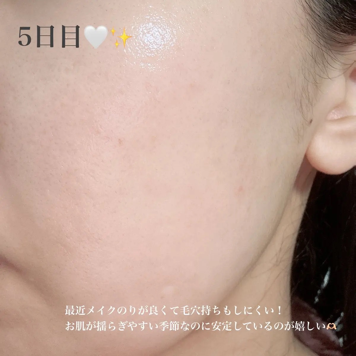 PDRN ハイドロゲルマスク/VT/シートマスク・パックを使ったクチコミ（2枚目）