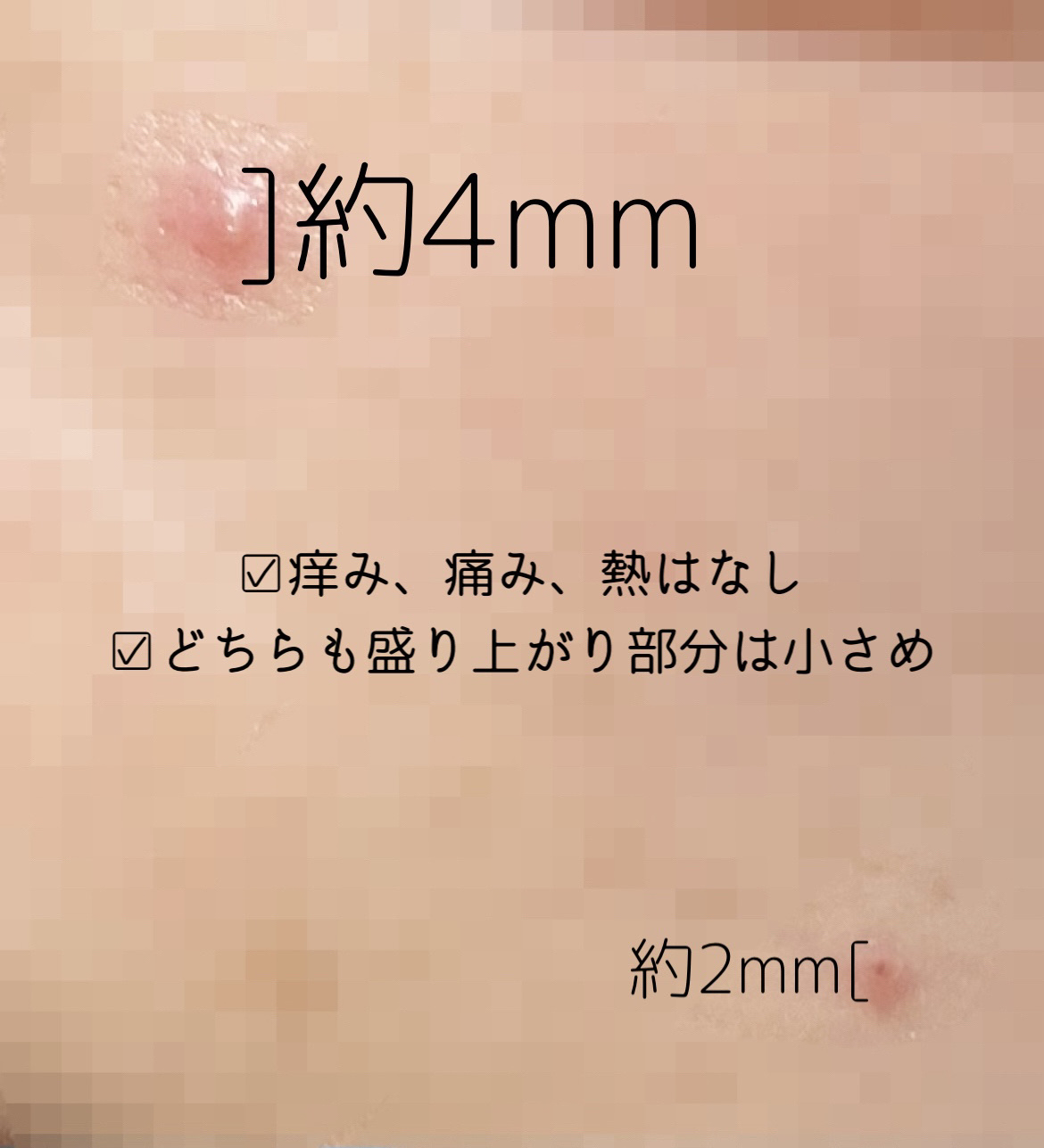 アクネ クラリファイング ローション/CLINIQUE/化粧水を使ったクチコミ（3枚目）