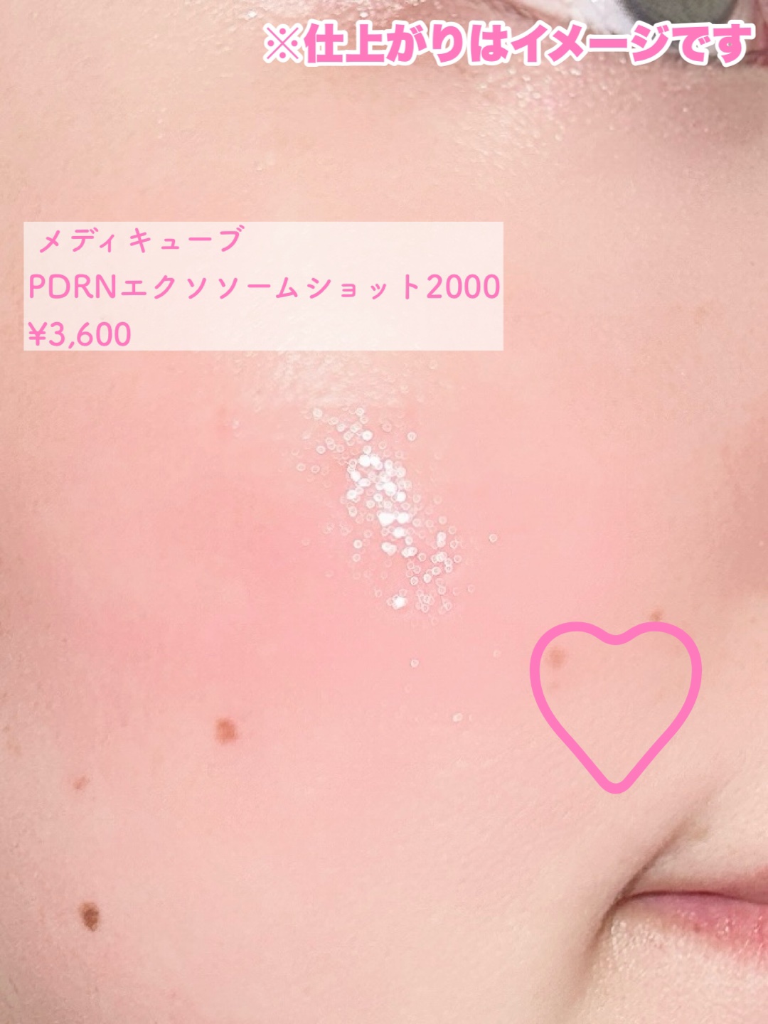 PDRNピンクエクソソームショット2000/MEDICUBE/美容液を使ったクチコミ（3枚目）