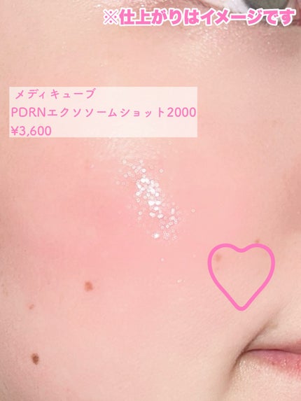 PDRNピンクエクソソームショット2000/MEDICUBE/美容液を使ったクチコミ(3枚目)