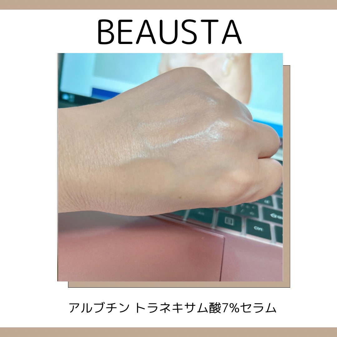 トラネキサム酸7%ダークソリューションクリーム/BEAUSTA/フェイスクリームを使ったクチコミ(4枚目)