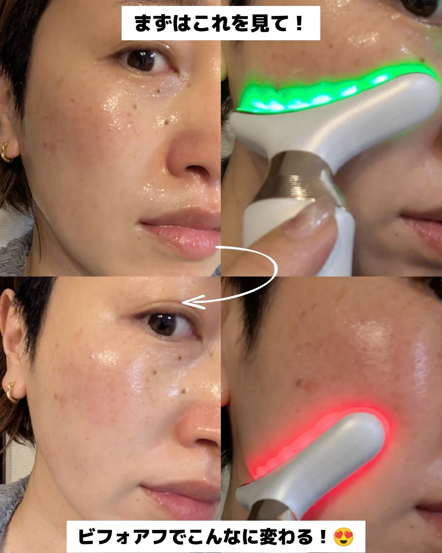 を使ったクチコミ（2枚目）