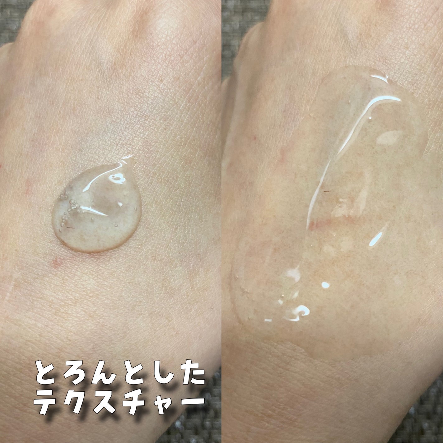 ハイドラAアンプル/Dr.lonnie/美容液を使ったクチコミ(5枚目)