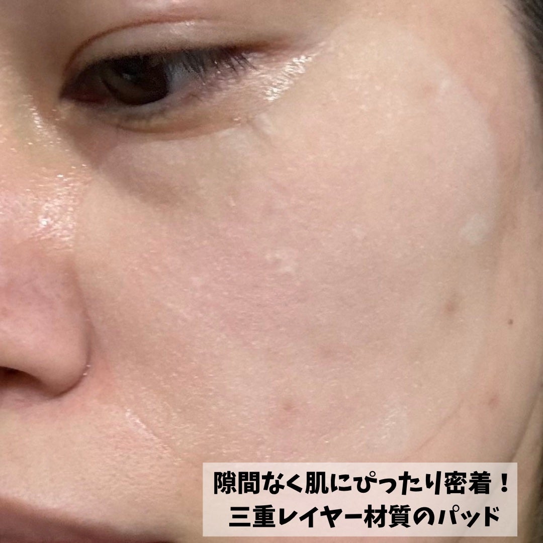 センテラ クイックカーミングパッド/SKIN1004/トナーパッドを使ったクチコミ(3枚目)