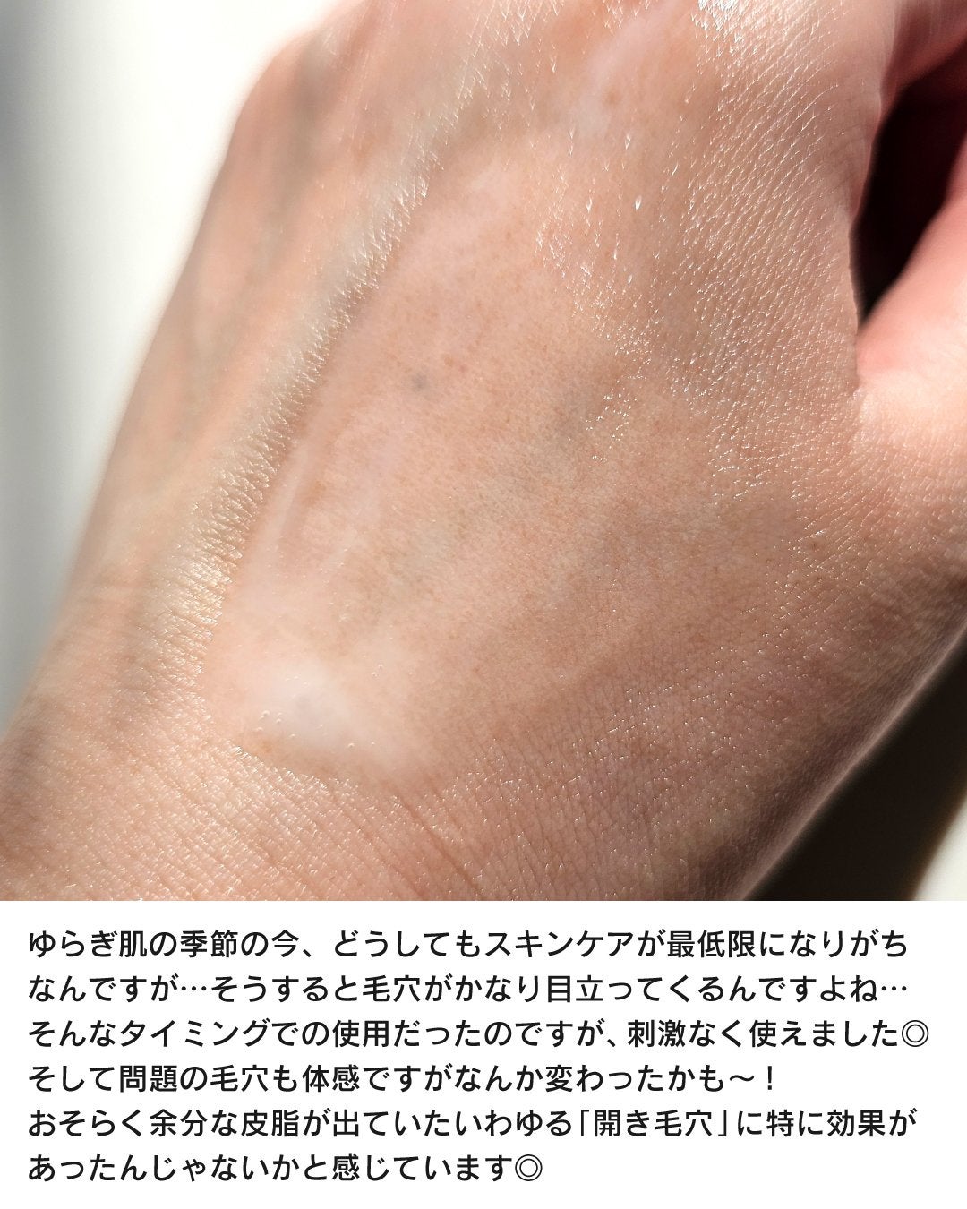 shoco_sme フォロバ on LIPS 「【敏感肌でも◎ガラクトミセス配合で毛穴ケア】ーーーーーーーーー..」(4枚目)