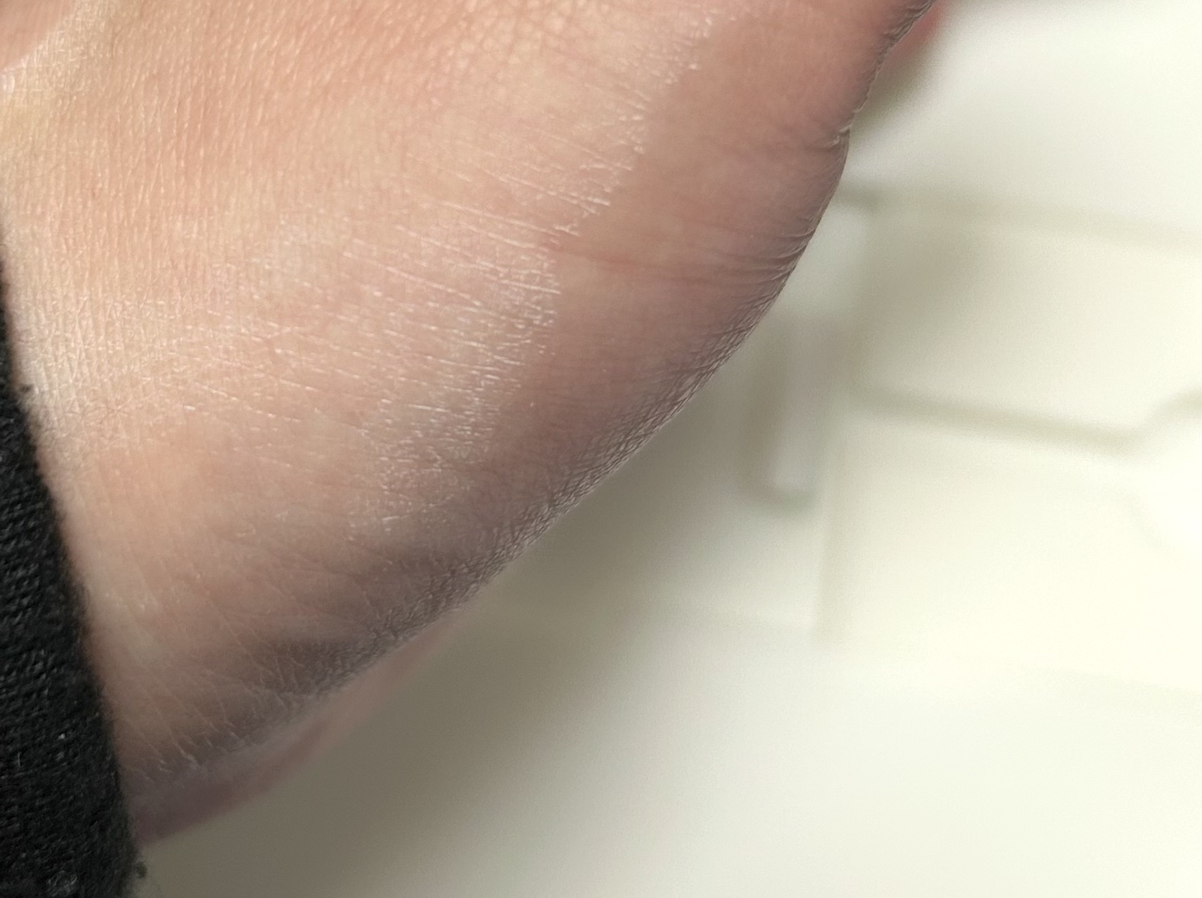 アゼライン酸16BBスージングセラム/MEDICUBE/美容液を使ったクチコミ（2枚目）