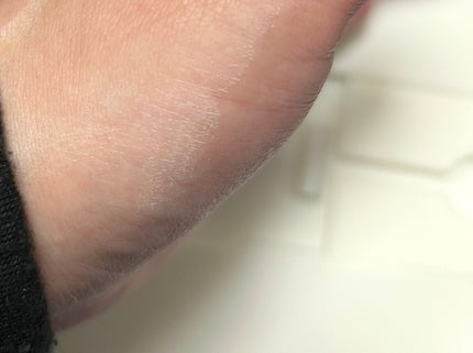 アゼライン酸16BBカーミングセラム/MEDICUBE/美容液を使ったクチコミ(2枚目)