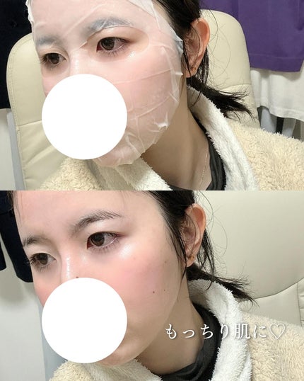 リードルS PDRN+ セラム/VT/美容液を使ったクチコミ(5枚目)