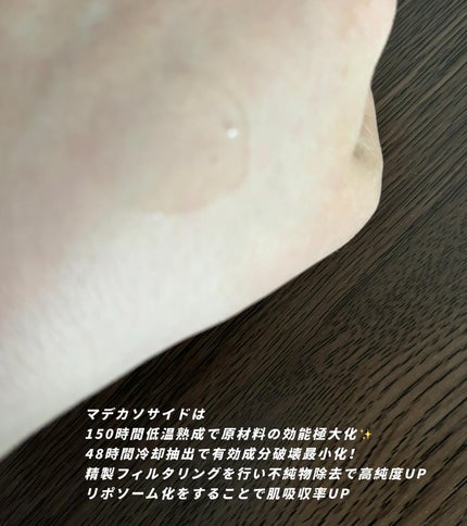 マデカッソシド エッセンシャルマスク/MEDIHEAL/シートマスク・パックを使ったクチコミ(3枚目)