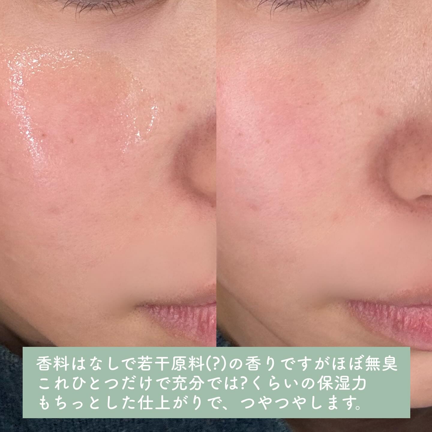 復活草ビフィダセラムファーミングドロップ/Abib /美容液を使ったクチコミ（3枚目）