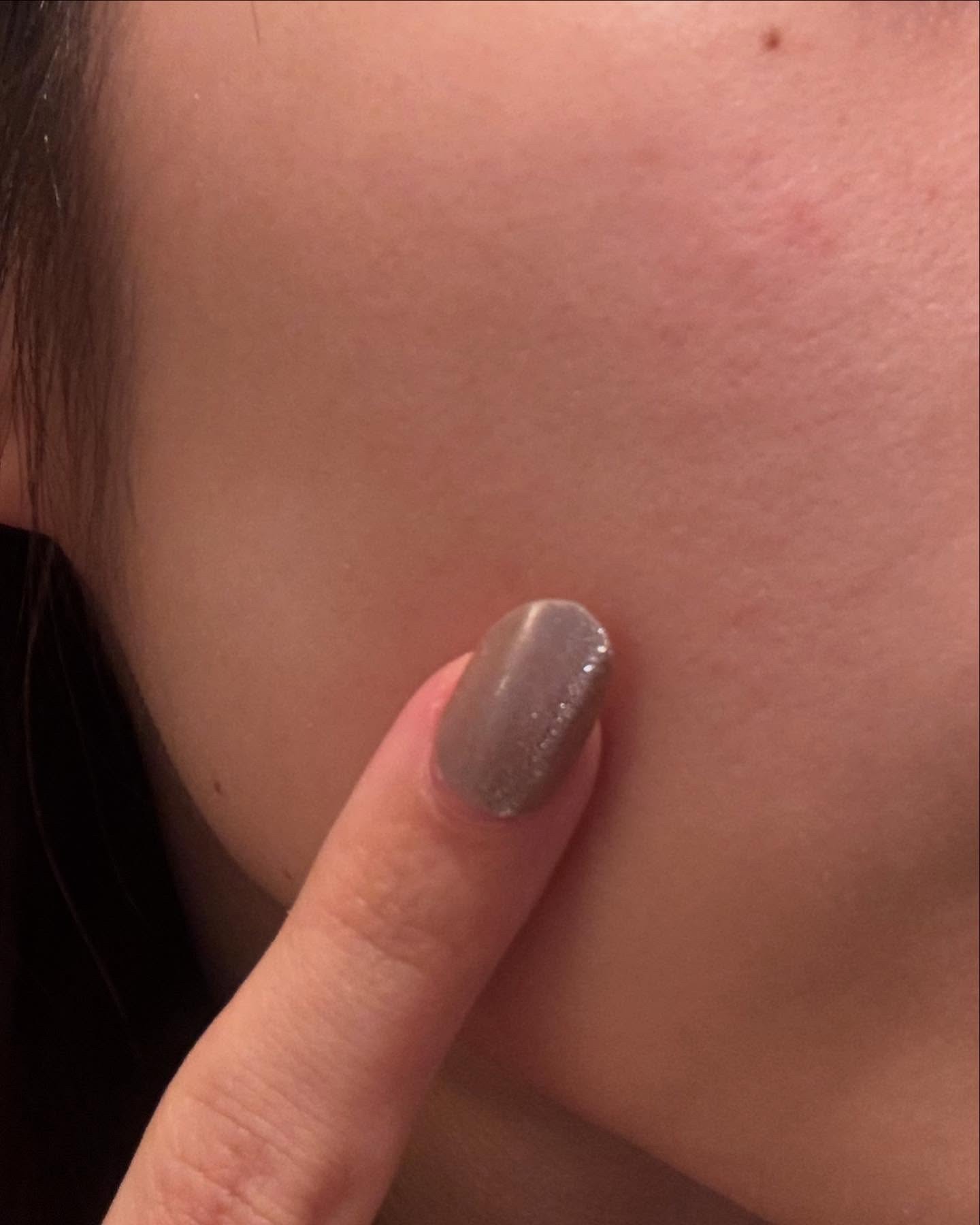 レチノール スーパーバウンス セラム/IOPE/美容液を使ったクチコミ（3枚目）