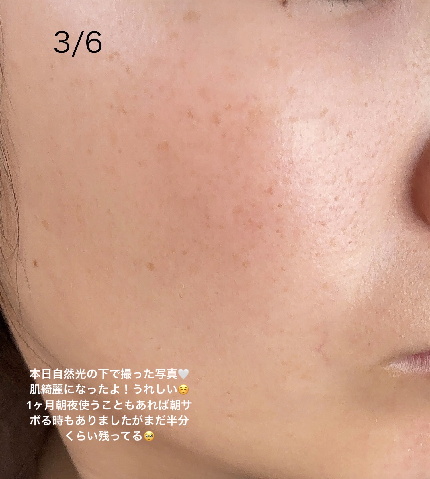 メラノフォーカスＥＶ/HAKU/美容液を使ったクチコミ（3枚目）