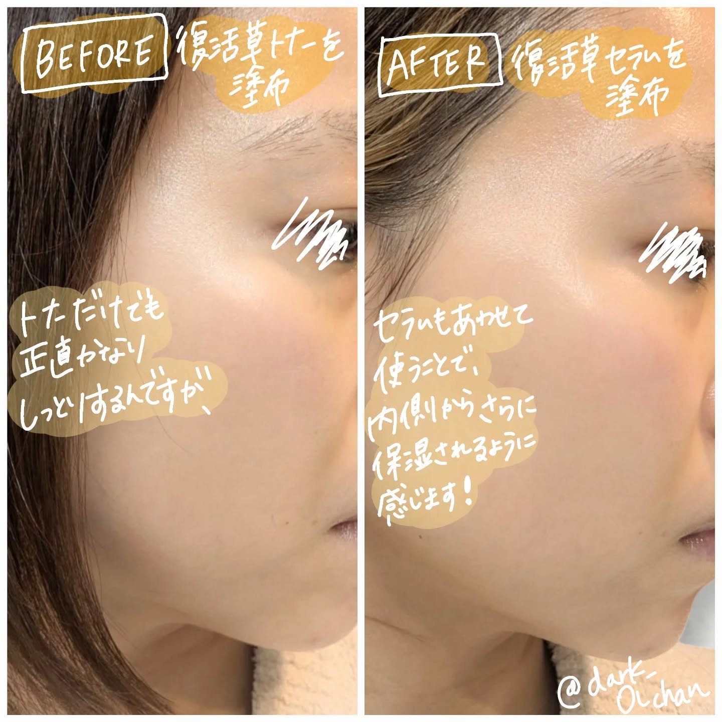 復活草ビフィダセラムファーミングドロップ/Abib /美容液を使ったクチコミ（2枚目）