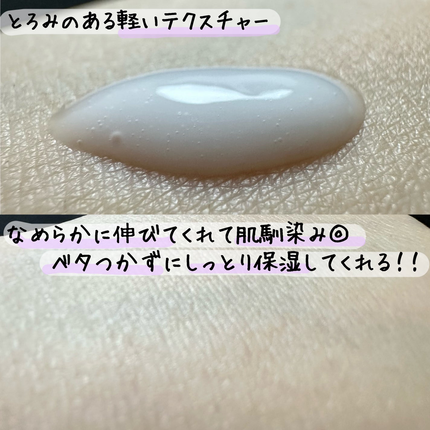 バクチオールポアジェットセラム/Dr.G/美容液を使ったクチコミ(3枚目)