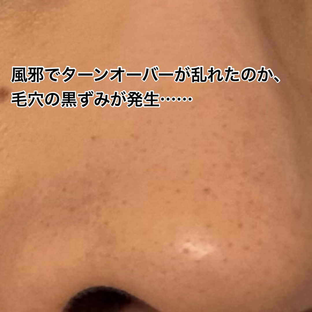 薬用しみ集中対策 プレミアム美容液/メラノCC/美容液を使ったクチコミ（2枚目）