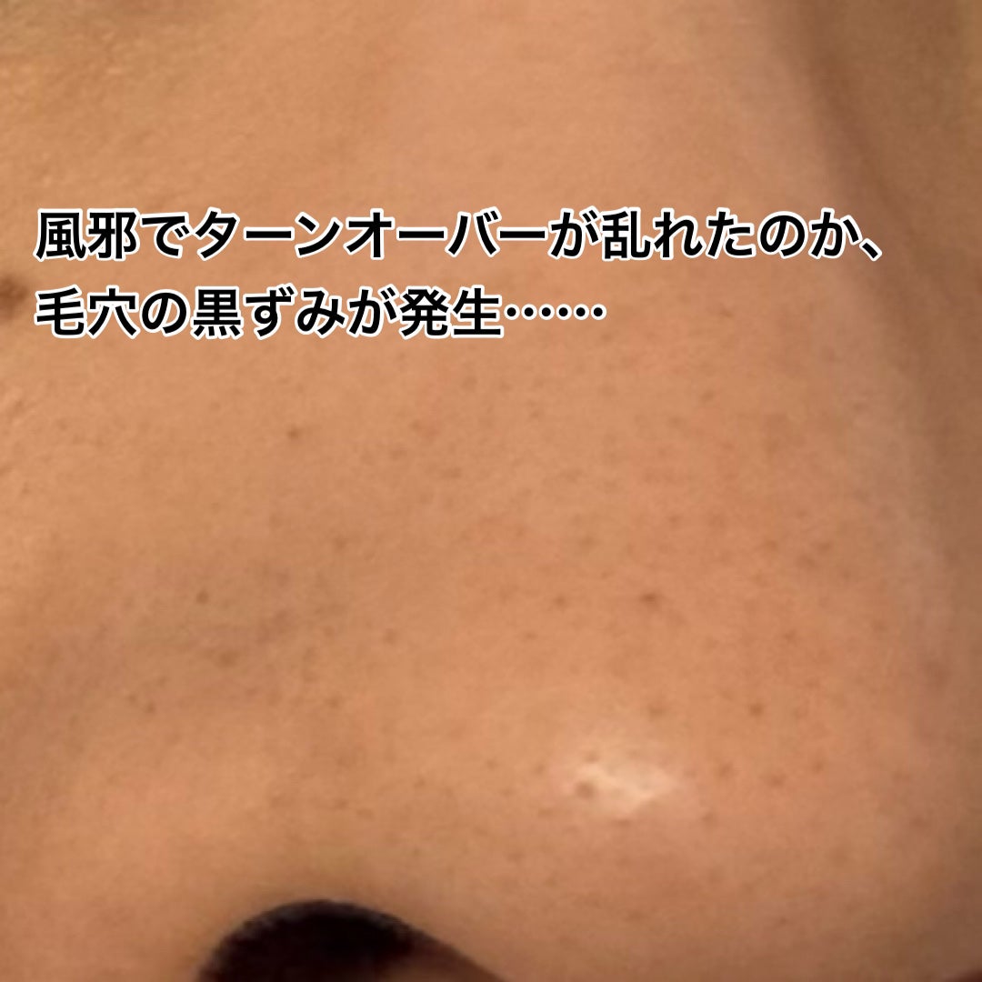 集中対策プレミアムマスクMK 高保湿タイプ/メラノCC/シートマスク・パックを使ったクチコミ(2枚目)