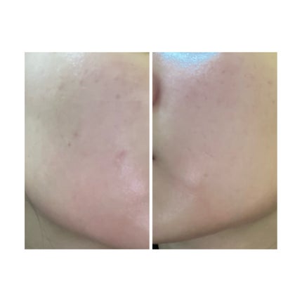 を使ったクチコミ(3枚目)