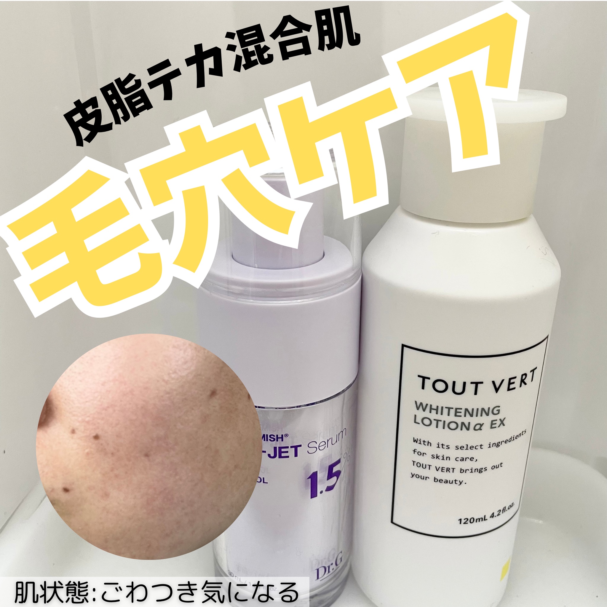 薬用ホワイトニングローションα EX/TOUT VERT/化粧水を使ったクチコミ（1枚目）