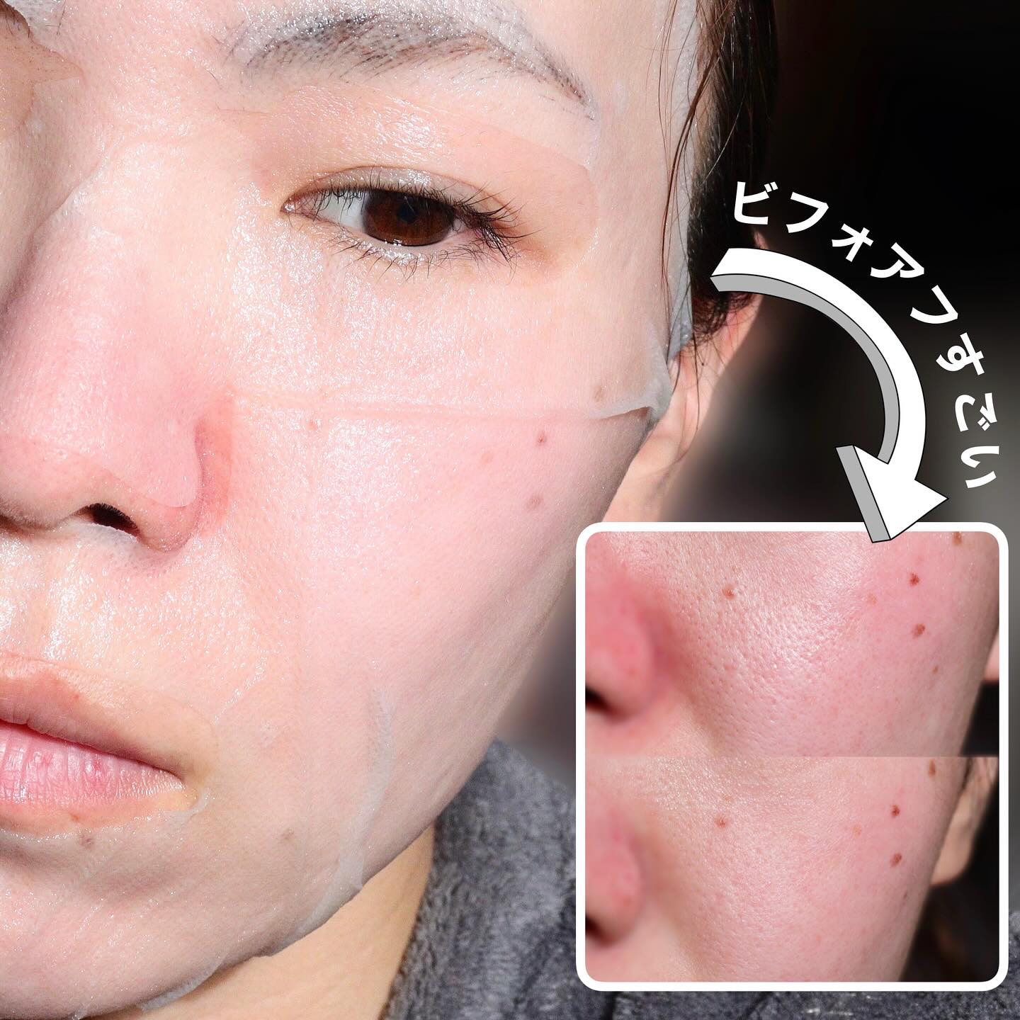 ピュアフィットシカカーミングトゥルーシートマスク /COSRX/シートマスク・パックを使ったクチコミ（3枚目）