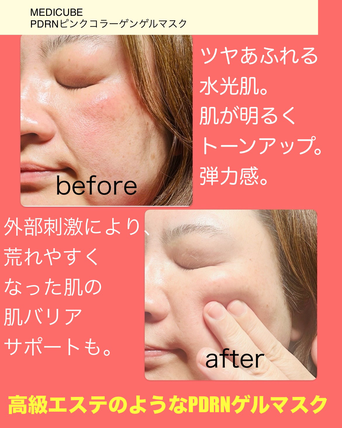 PDRNピンクコラーゲンゲルマスク/MEDICUBE/シートマスク・パックを使ったクチコミ（3枚目）