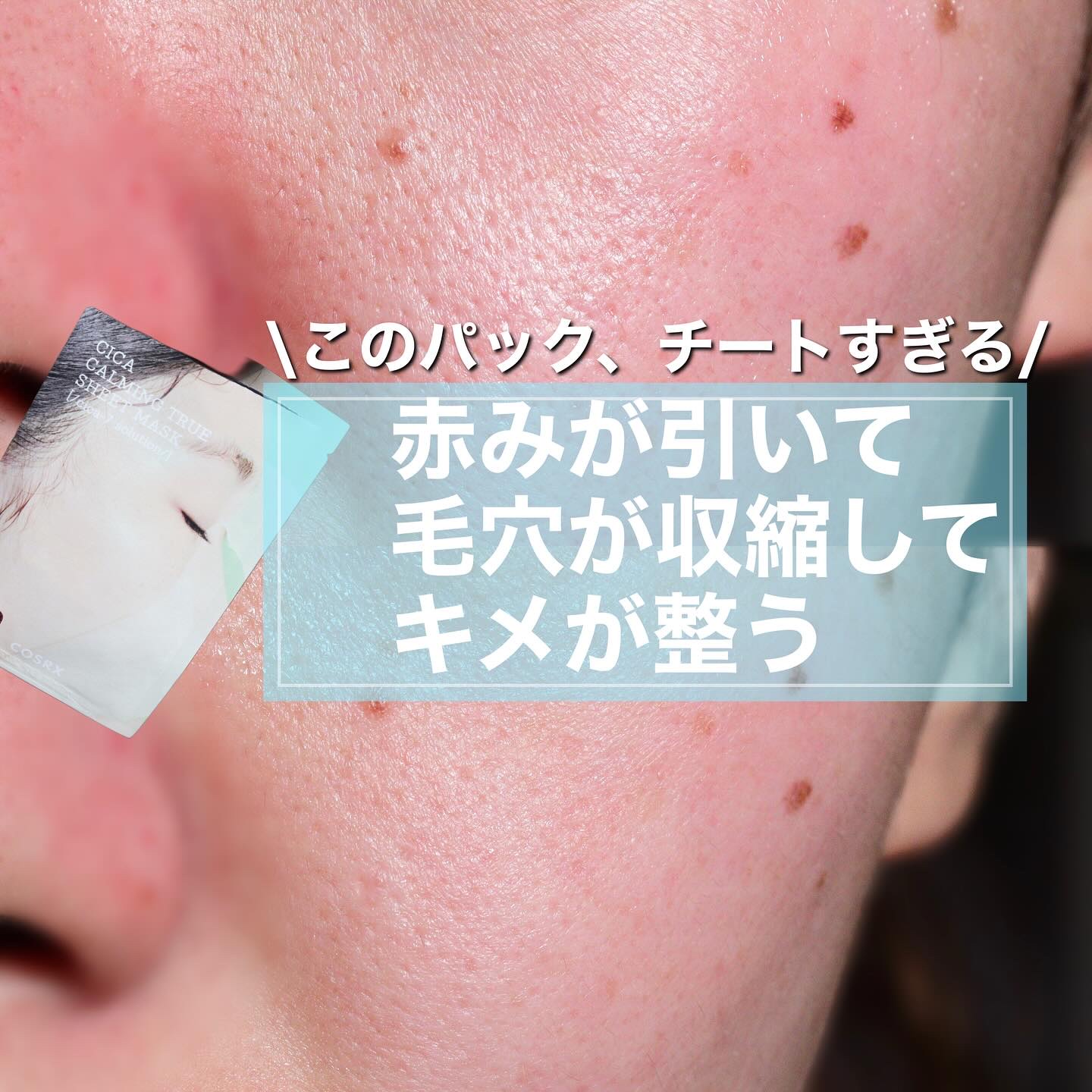 ピュアフィットシカカーミングトゥルーシートマスク /COSRX/シートマスク・パックを使ったクチコミ（1枚目）