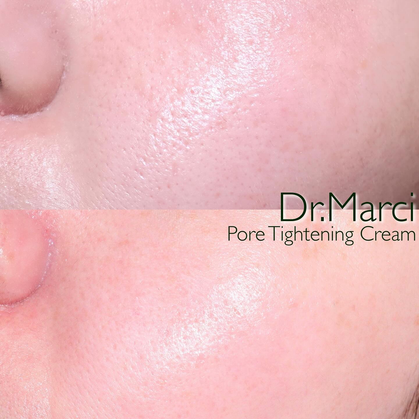 ドクターマルシー ポアタイトニングクリーム/ドクターマルシー/フェイスクリームを使ったクチコミ（1枚目）