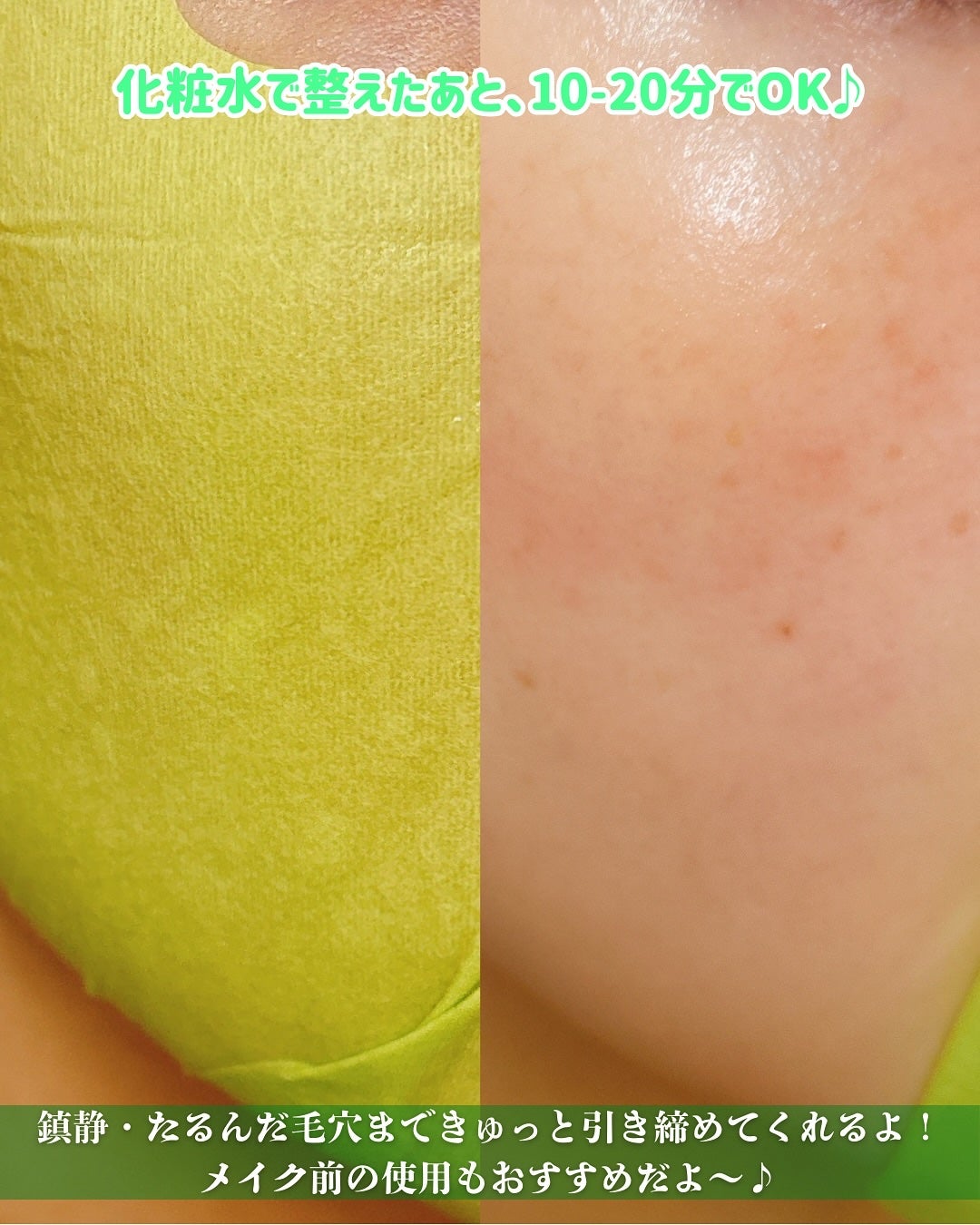 ACコントロールEXディープマスク/DEWYTREE/シートマスク・パックを使ったクチコミ(5枚目)