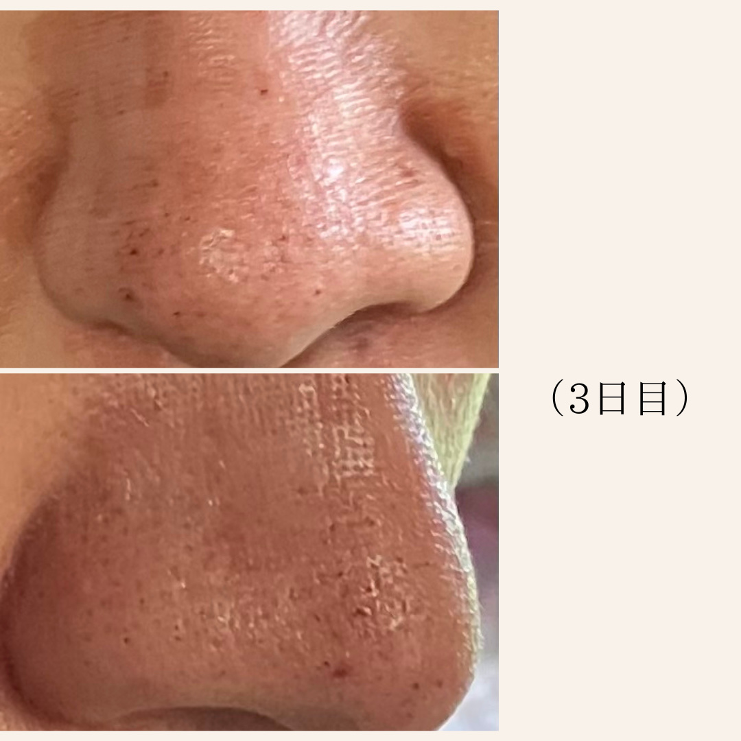 アルティミューン™ パワライジング セラム/SHISEIDO/美容液を使ったクチコミ（3枚目）