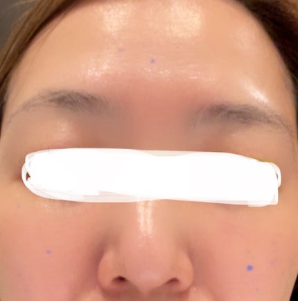 HAKU メラノフォーカスIV/HAKU/美容液を使ったクチコミ(3枚目)