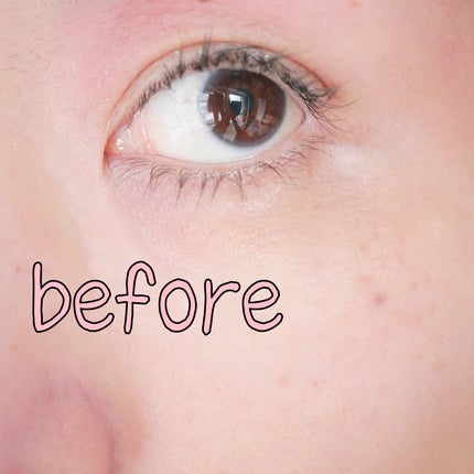 ビタトーニングカプセルセラム/ダルバ/美容液を使ったクチコミ(5枚目)