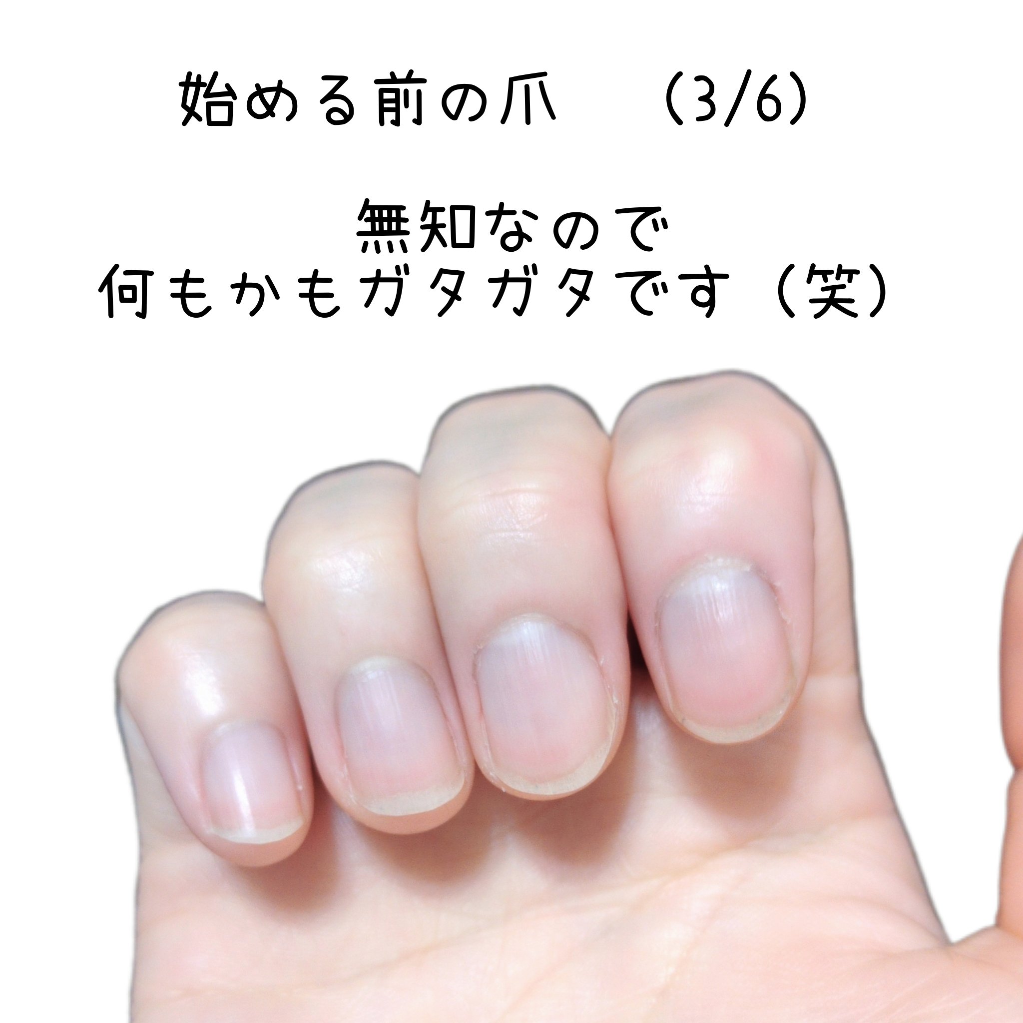 キューティクルオイル/ネイルホリック/ネイルオイル・トリートメントを使ったクチコミ（2枚目）