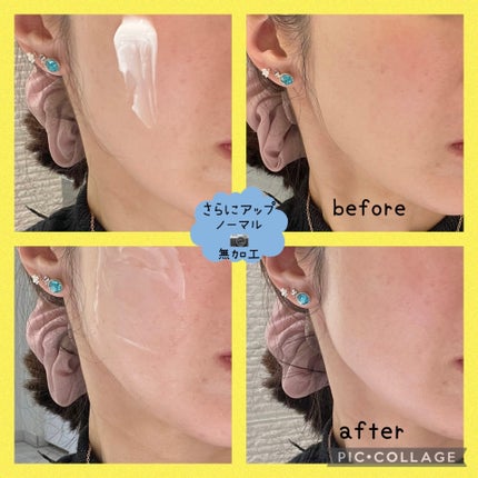 レッドブレミッシュ クリアモイスチャークリーム/Dr.G/フェイスクリームを使ったクチコミ(4枚目)