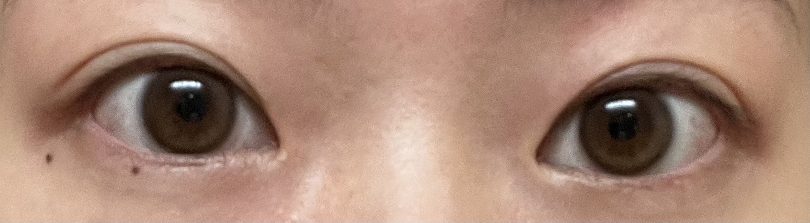 超モテコンウルトラマンスリー/モテコン/１ヶ月（１MONTH）カラコンを使ったクチコミ（3枚目）