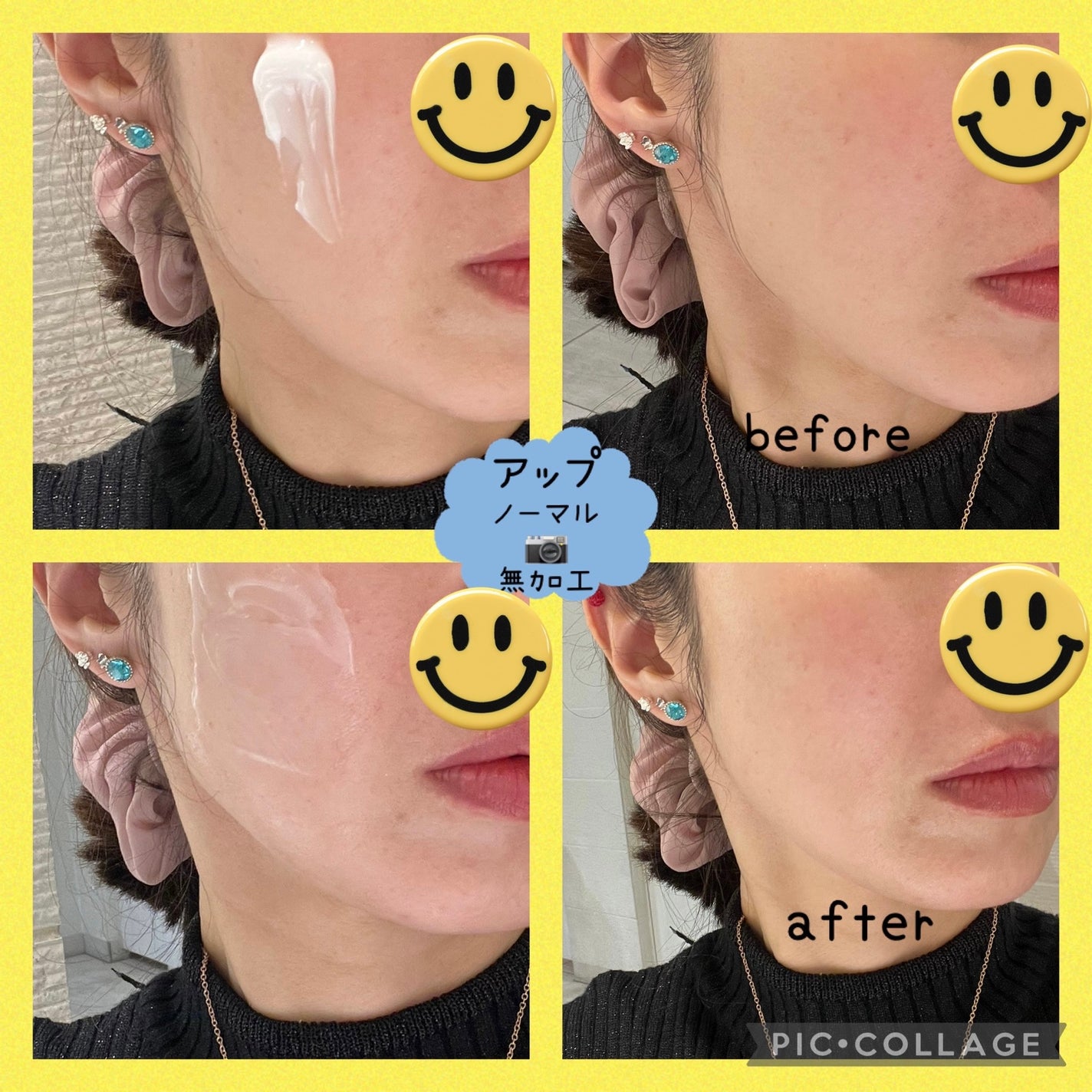 レッドブレミッシュ クリアモイスチャークリーム/Dr.G/フェイスクリームを使ったクチコミ(3枚目)