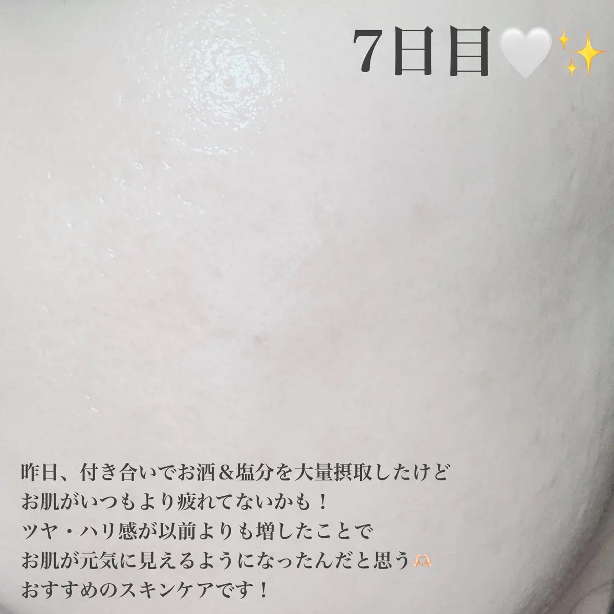 PDRN ハイドロゲルマスク/VT/シートマスク・パックを使ったクチコミ（2枚目）