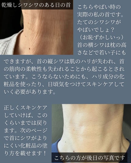 asari*老化に抵抗しつづける40代 on LIPS 「\8割が間違っている/\首のスキンケア方法/「老けたなぁ私が実..」(5枚目)