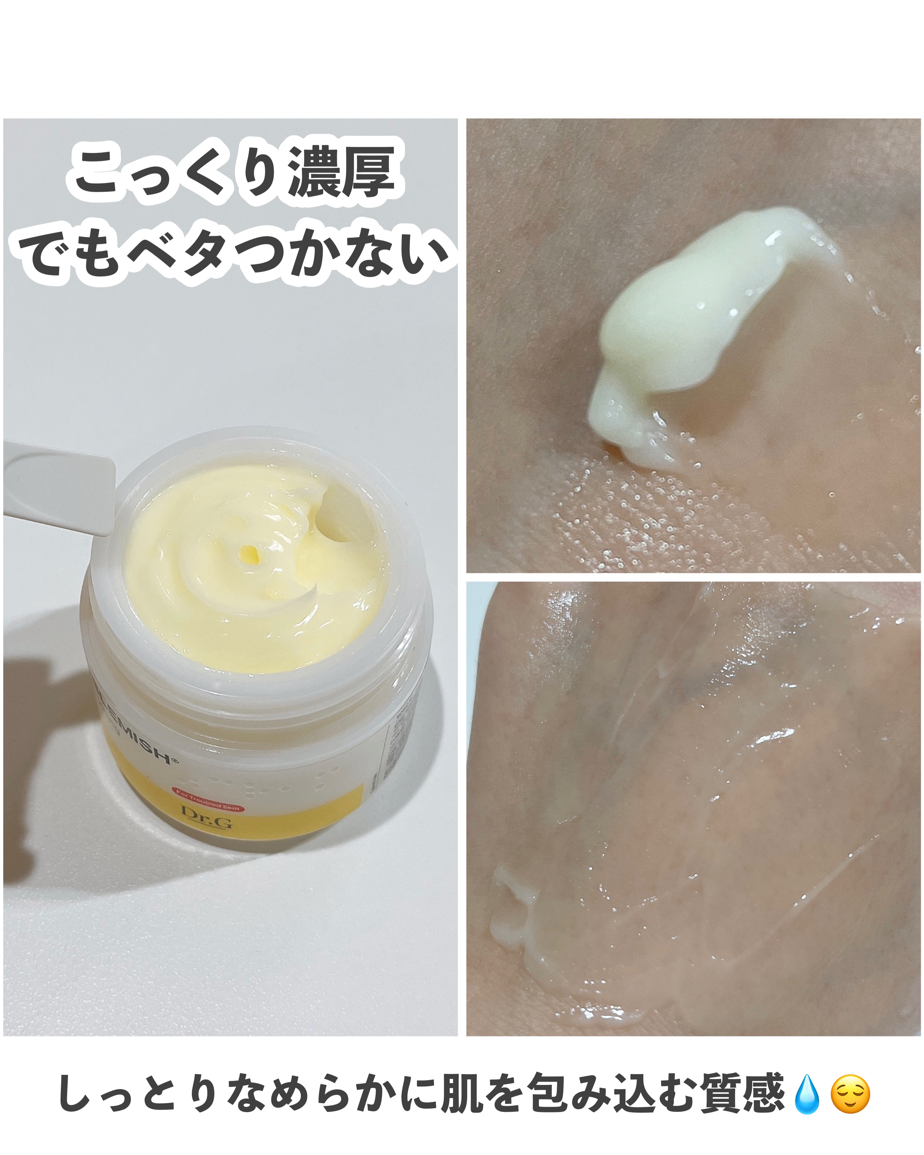 レッドブレミッシュ リペアスージングクリーム/Dr.G/フェイスクリームを使ったクチコミ（3枚目）