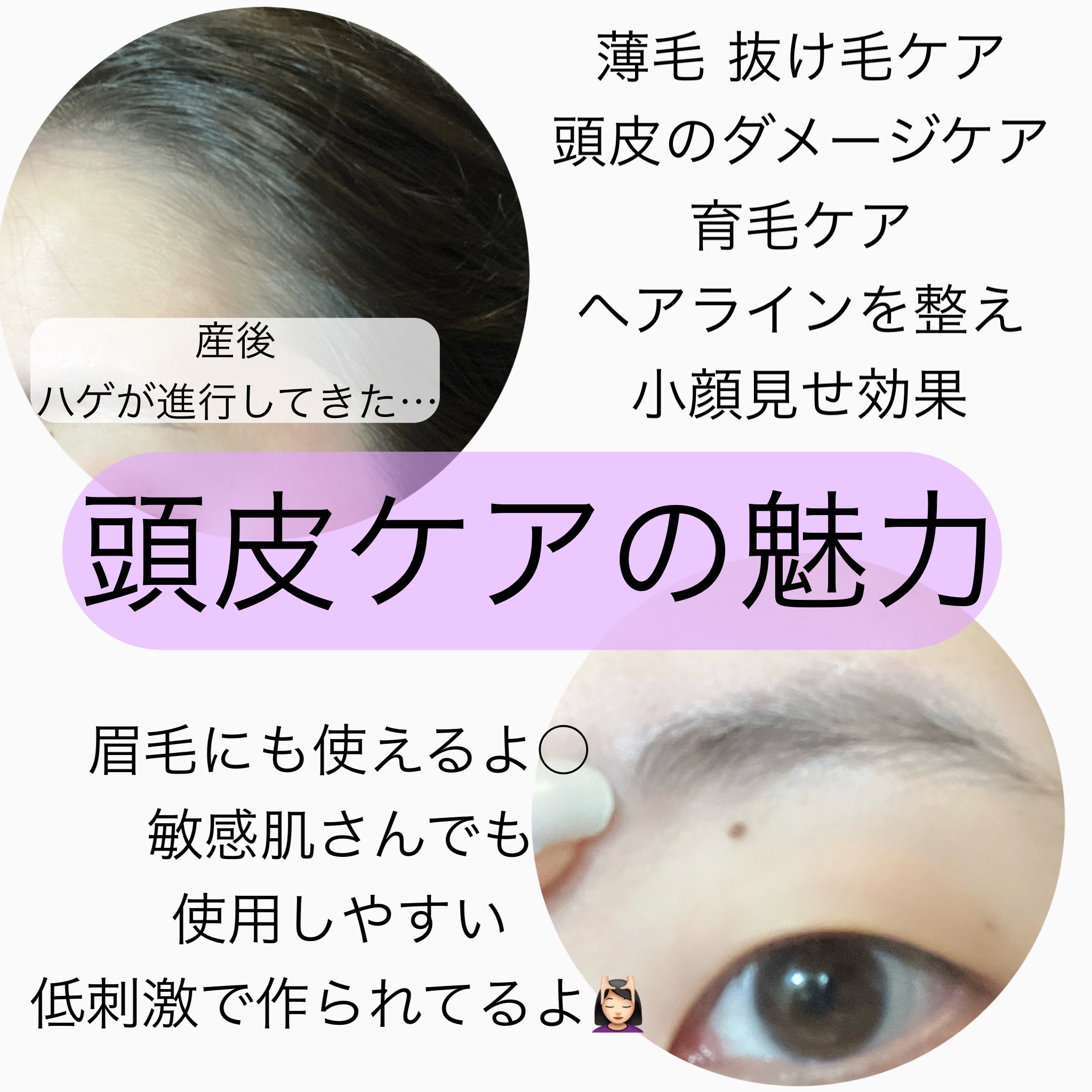 ドリームヘアブースターセラム/RayMoon/頭皮ローションを使ったクチコミ（3枚目）