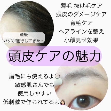 ドリームヘアブースターセラム/RayMoon/頭皮ローションを使ったクチコミ(3枚目)