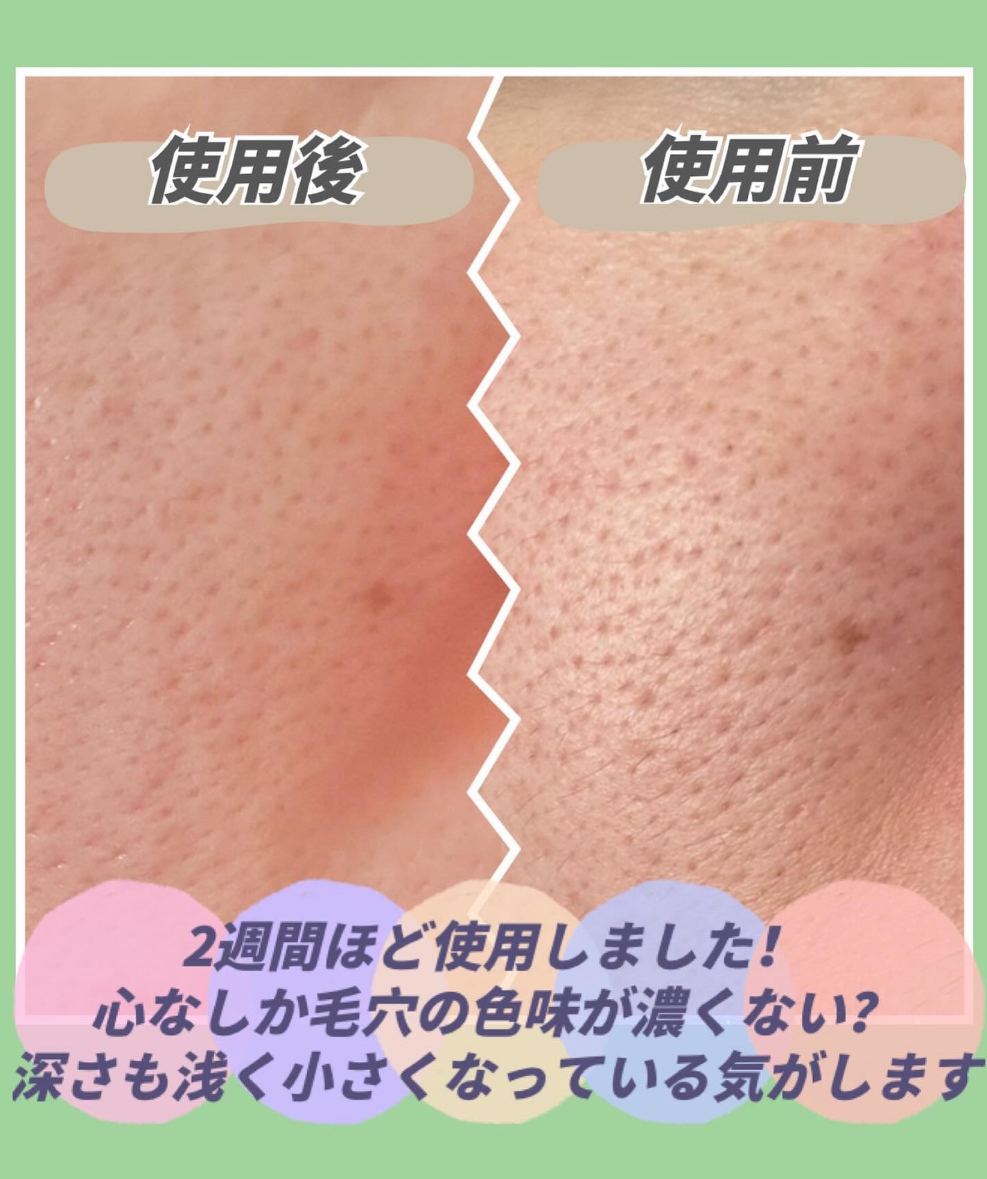 PDRNデイリーマスクパック/COSNORI/その他スキンケアを使ったクチコミ(5枚目)