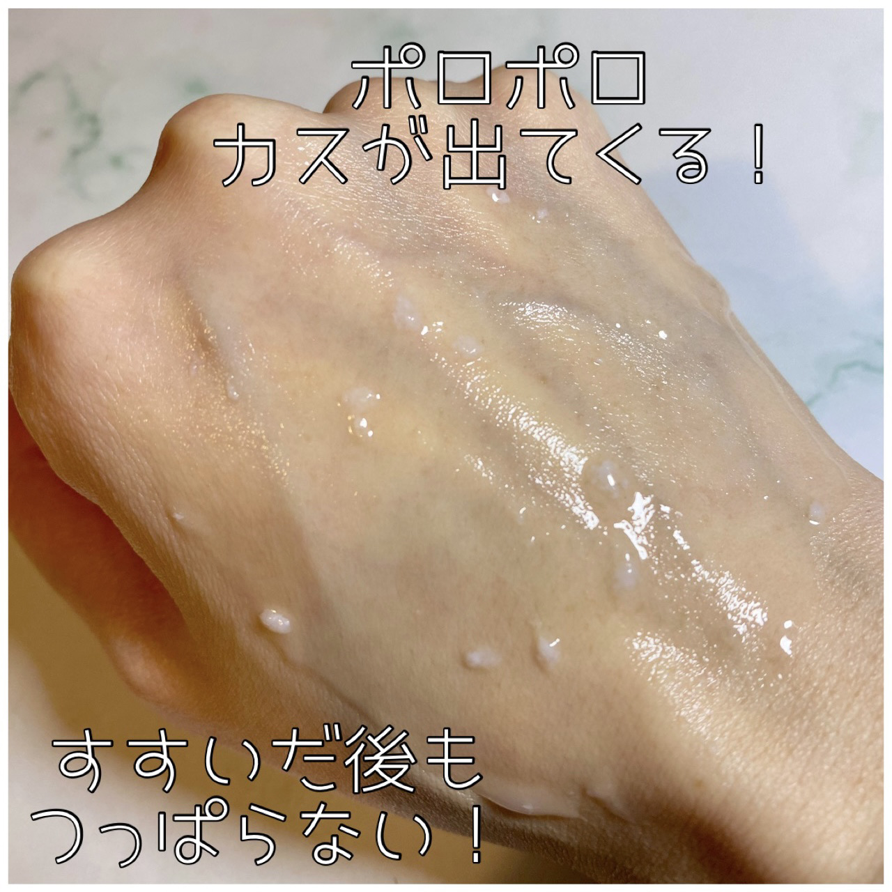 プラチナレーベル ヒト幹細胞エキス(＊1)配合 ピーリング(＊4)ジェル/プラチナレーベル/ピーリングを使ったクチコミ（3枚目）