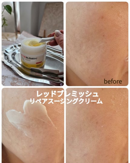 kaori on LIPS 「#DRG皮膚科学に基づくスキンケアブランド、ドクタージーの商品..」(5枚目)