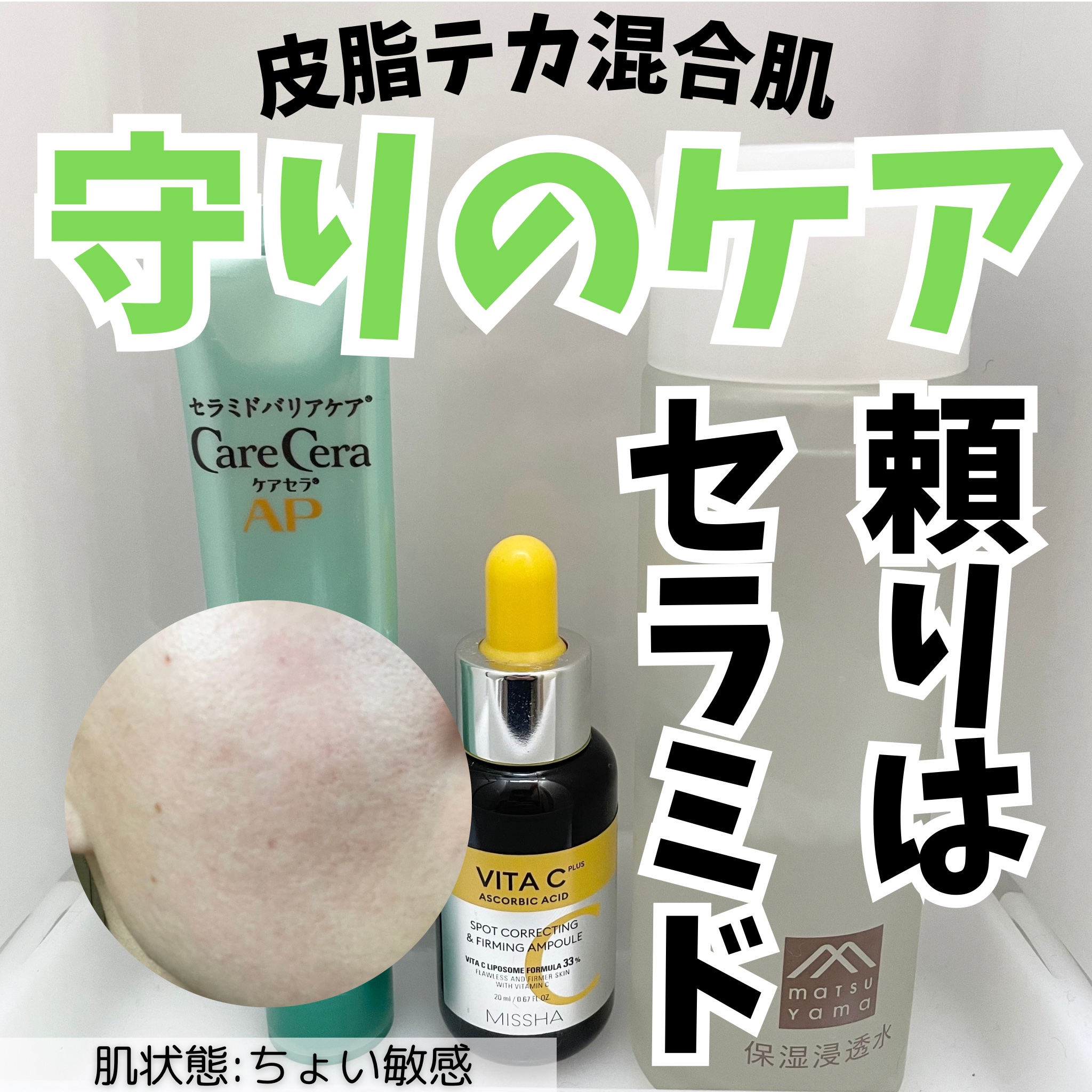 ケアセラAP 高保湿バリアスキンバーム/ケアセラ/フェイスバームを使ったクチコミ（1枚目）