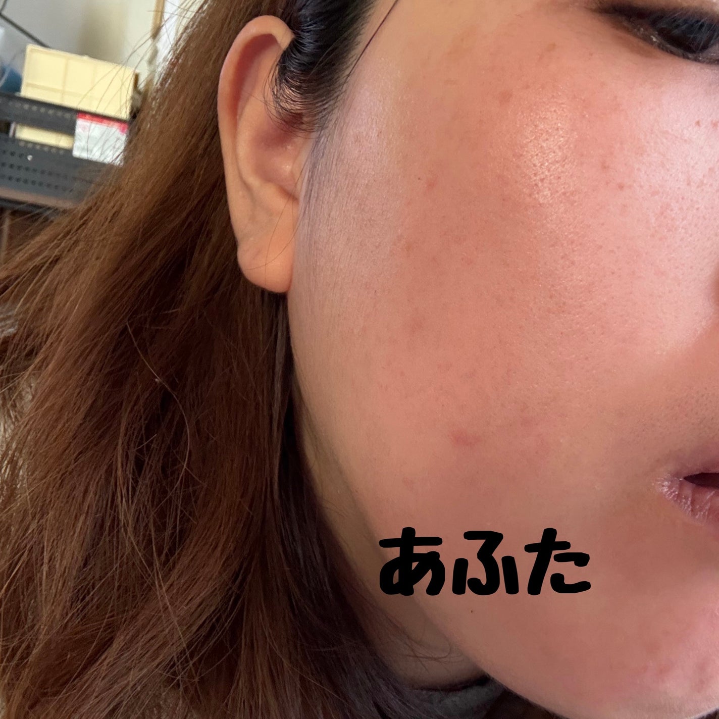 ELT VITA YOUTH ビタユース セラム/ELT COSMETICS/美容液を使ったクチコミ(6枚目)