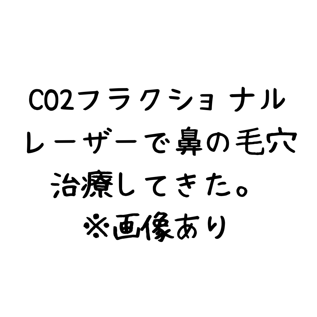 アルティミューン™ パワライジング セラム/SHISEIDO/美容液を使ったクチコミ（1枚目）