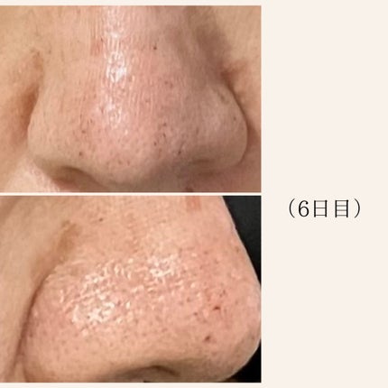 アルティミューン™ パワライジング セラム/SHISEIDO/美容液を使ったクチコミ(5枚目)