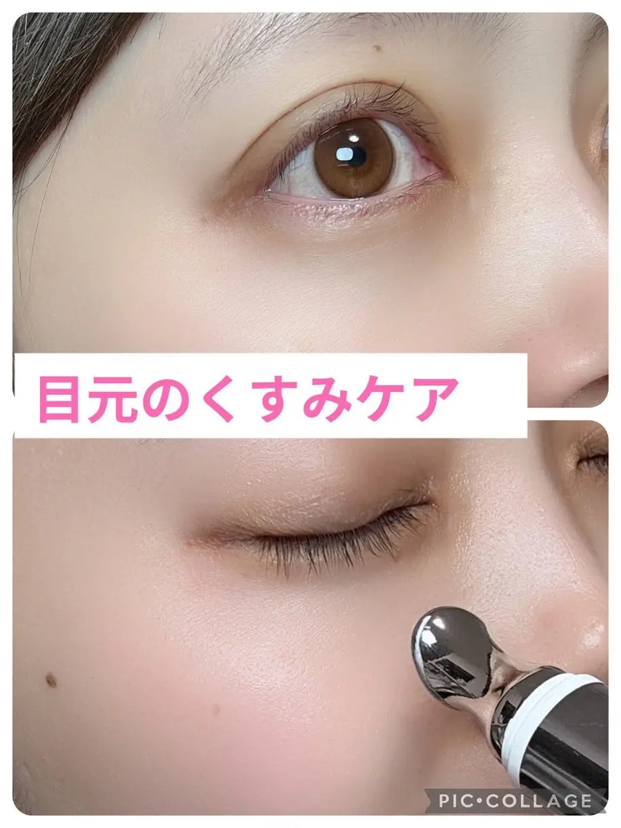 デュアルダムガーラックビタCオートアイクリーム/Dr.Twenty Project/アイケア・アイクリームを使ったクチコミ（2枚目）