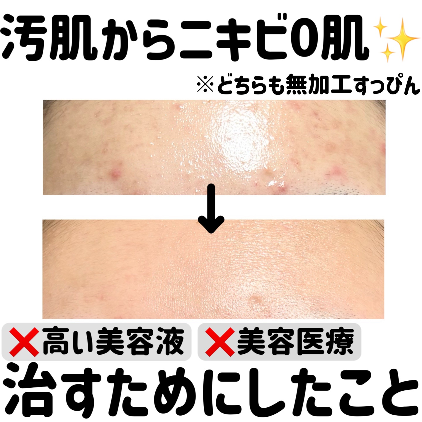 クリアフル ウォッシュ/オルビス/洗顔フォームを使ったクチコミ（1枚目）