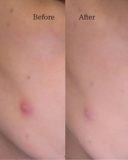 fuyouu on LIPS ãðQoo10ã¡ã¬å²ãããããã¯ãã·ã§ã³ðMoonshotã³ã³ã·..ãïŒ4æç®ïŒ